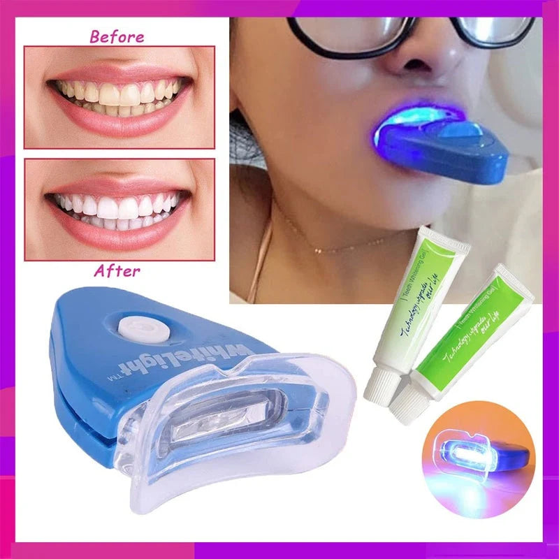 Yellow Teeth Solution – At-Home Tooth Whitening System